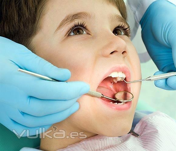 Tu dentista en Benimaclet, Valencia. nios infantil caries