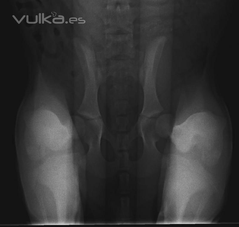 Radiografa de distraccin PennHip para diagnstico de displasia deHospital Veterinario Marina Baixa