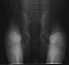 Radiografia de distraccion pennhip para diagnostico de displasia dehospital veterinario marina baixa