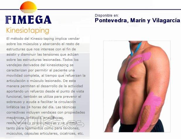 El mtodo del Kinesio taping implica vendar sobre los msculos y abarcando el resto de estructuras