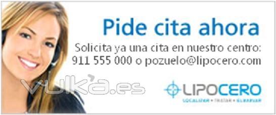 Pide cita ahora: 91-1555000