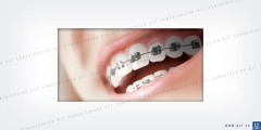 Ilustracion boca - dentadura - ortodoncia