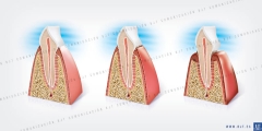 Ilustracion dientes seccionados