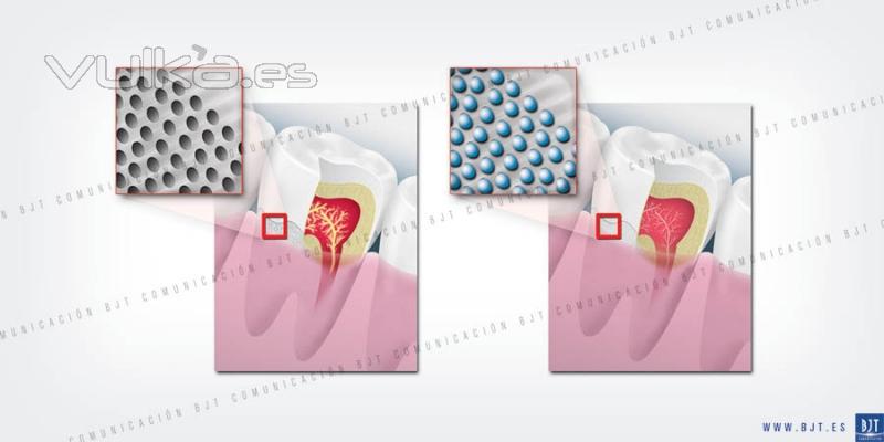 ILUSTRACION DIENTES SENSIBLES