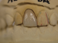 Laboratorio dental marzal - foto 14