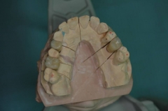 Finalizacion de la ceramica