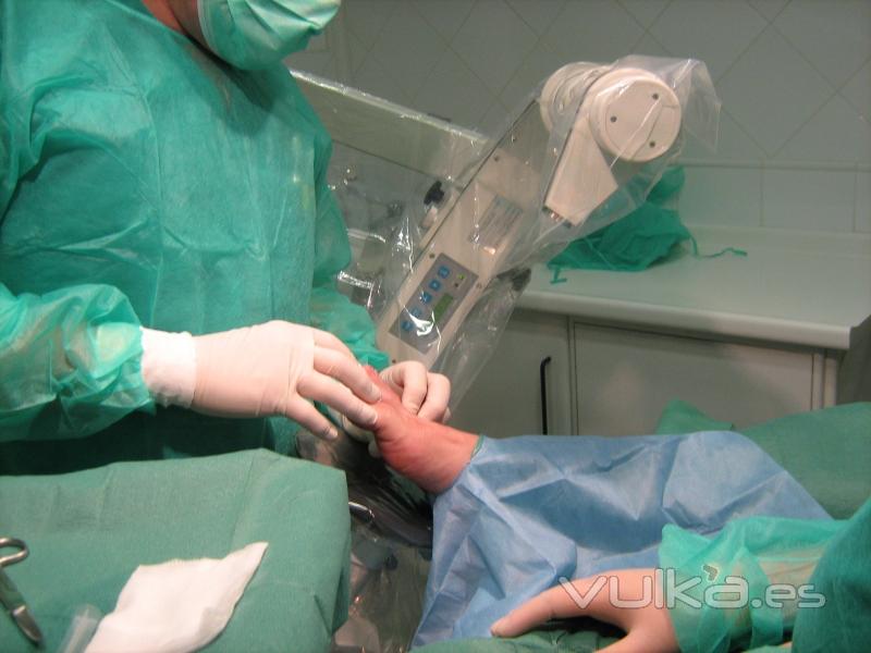 cirurgia del peu per tecnica quirurgica de minima incisió