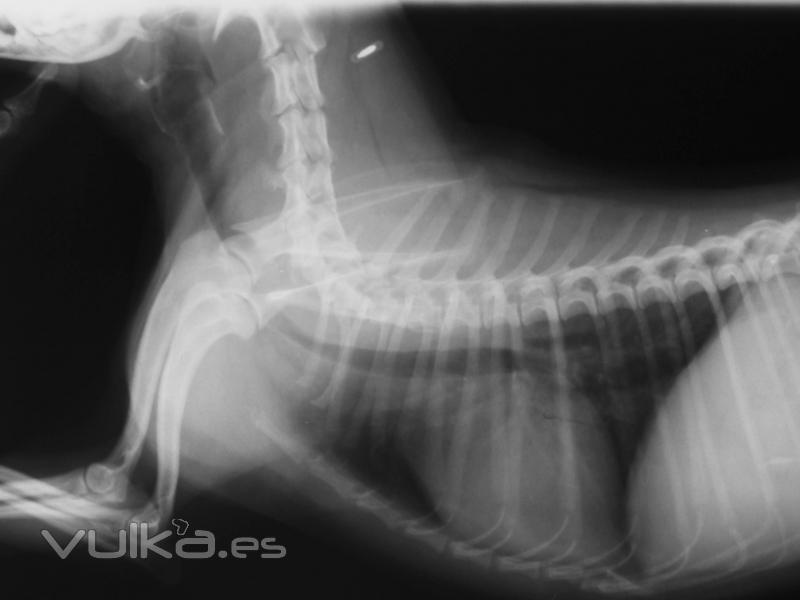 RAdiografia de torax y cuello 