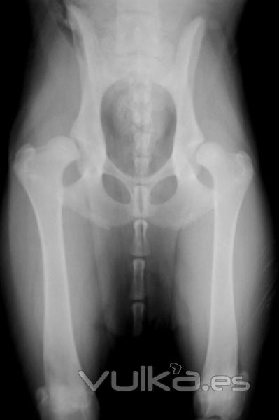 Radiografias oficiales de displasia