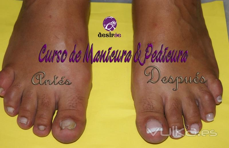 Pedicura_Antes_Despues