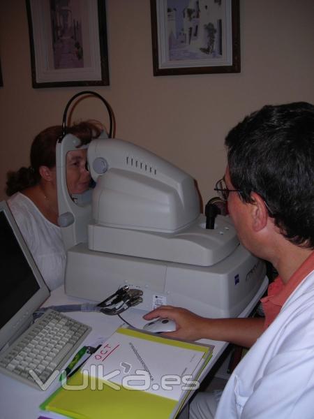tomografia de macula