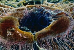 Macula en 3 dimensiones