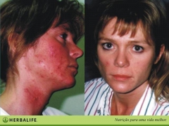 Herbalife-distribuidores independientes - foto 16
