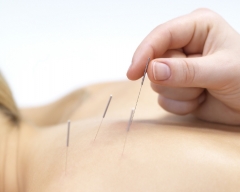 La acupuntura es el método más efectivo de curación para problemas musculares y articulares,.