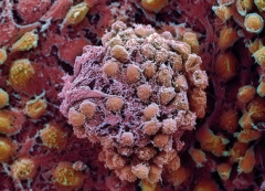 Celula madre implantada en retina