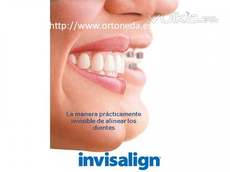 Ortodoncia Invisible. Invisalign
