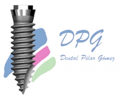Implante dental jjg evolution implant system