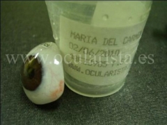 Yepes ocularista - foto 21