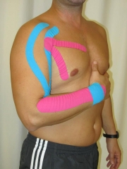 Vendaje neuromuscular
