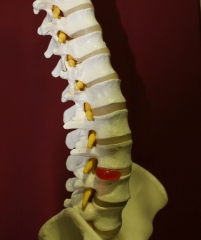 Algias de la columna vertebral - osteopata