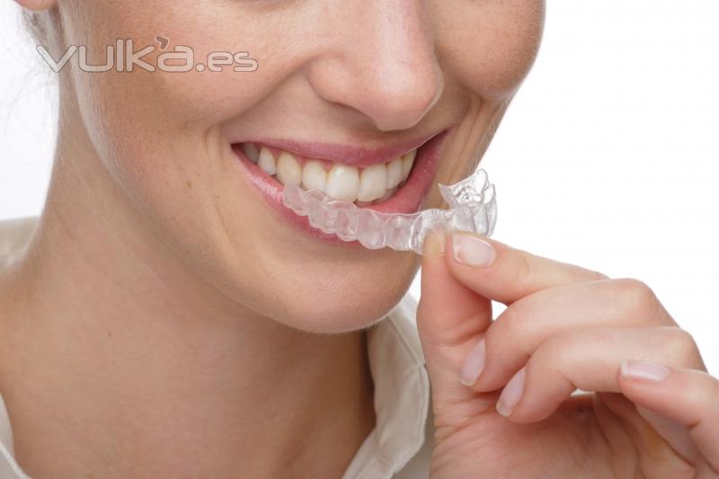 Invisalign