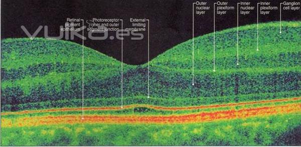 capas de la retina