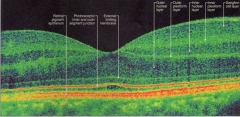 Capas de la retina