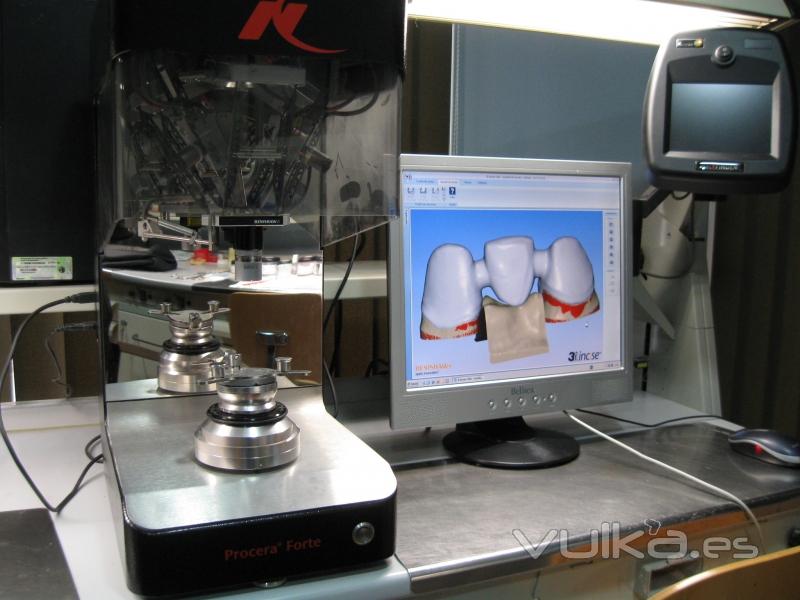 puente zirconia realizada con la tecnica cad-cam