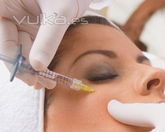 Mesoterapia facial