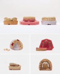 Foto 15 prtesis dentales en Barcelona - Glassdent S.l.