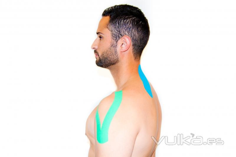 kinesio-taping