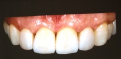 Stetica dental
