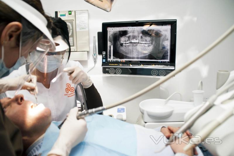 Colocación implante dental