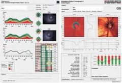 Tomografia laser, diagnostico