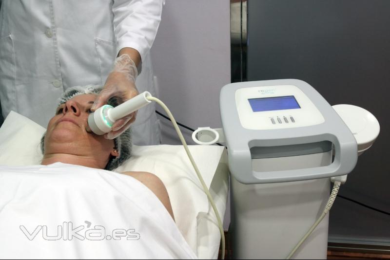 Tratamiento facial radiofrecuencia Regen XL