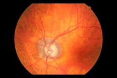 Atrof peripap