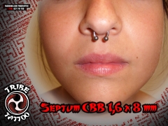 Septum por kurto