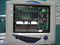 Monitor multiparametrico en quirofano para mayor seguridad en las cirugias