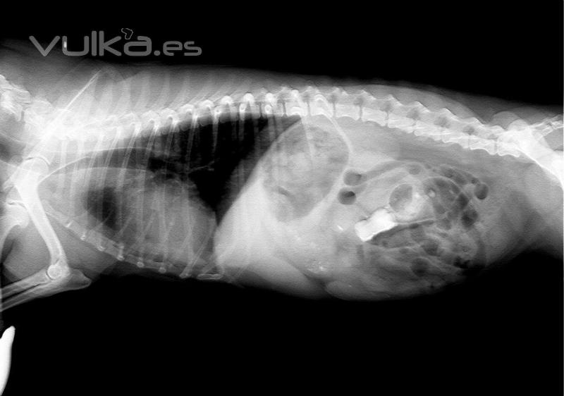 Radiografía DIgital (cuerpo extaño intestinal)