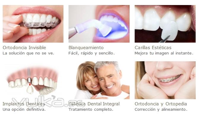 Integra Clinic Tratamientos dentales
