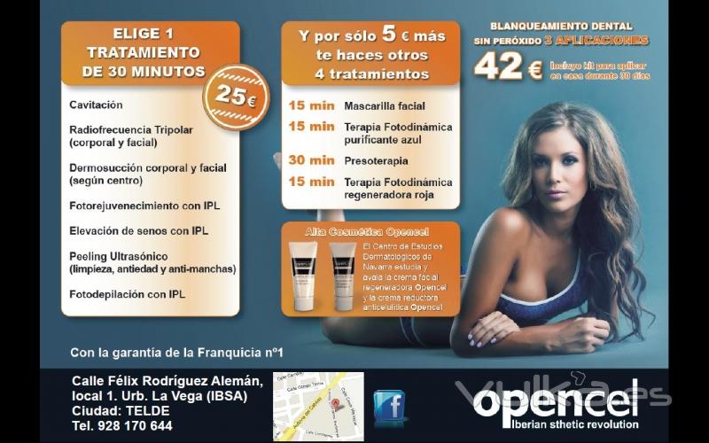 Opencel (Telde)