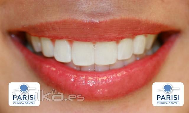 Clnica Dental - Parisi - Madrid - Carabanchel - Vista Alegre - http://www.clinicaparisi.es