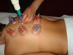 Ventosas para movilizar el qi de los organos