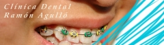 Clnica dental ramn agull en elche
