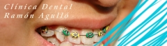 Clinica dental ramon agullo en elche