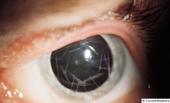 Clnica ocular estepona   dr. rodrguez chico    - foto 1