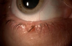 Clnica ocular estepona   dr. rodrguez chico    - foto 13