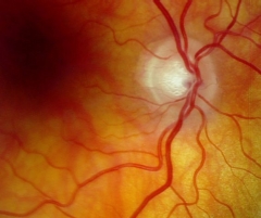 Clinica ocular estepona   dr rodriguez chico    - foto 16