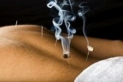 Moxibustion