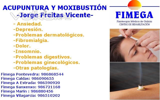 Fimega Acupuntura y Moxibustión